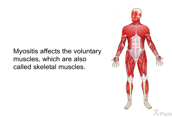 Myositis affects the voluntary muscles, which are also called skeletal muscles.