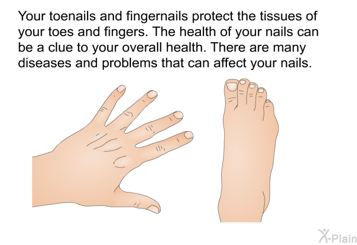Your toenails and fingernails protect the tissues of your toes and fingers. The health of your nails can be a clue to your overall health. There are many diseases and problems that can affect your nails.