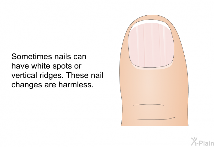 Sometimes nails can have white spots or vertical ridges. These nail changes are harmless.
