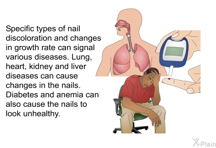 Specific types of nail discoloration and changes in growth rate can signal various diseases. Lung, heart, kidney and liver diseases can cause changes in the nails. Diabetes and anemia can also cause the nails to look unhealthy.