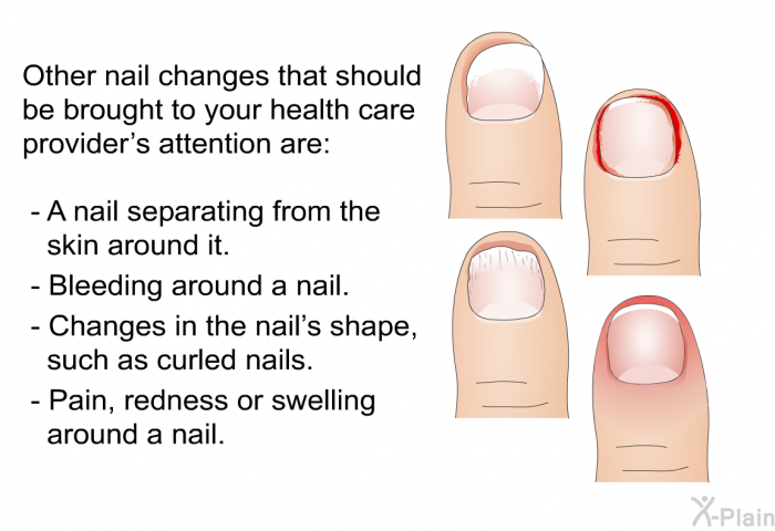 Other nail changes that should be brought to your health care provider's attention are:  A nail separating from the skin around it. Bleeding around a nail. Changes in the nail's shape, such as curled nails. Pain, redness or swelling around a nail.