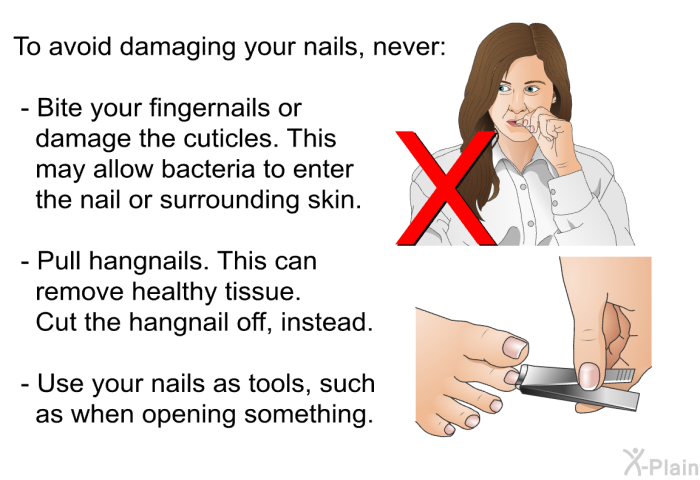 To avoid damaging your nails, never:  Bite your fingernails or damage the cuticles. This may allow bacteria to enter the nail or surrounding skin. Pull hangnails. This can remove healthy tissue. Cut the hangnail off, instead. Use your nails as tools, such as when opening something.