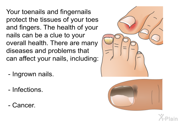 Your toenails and fingernails protect the tissues of your toes and fingers. The health of your nails can be a clue to your overall health. There are many diseases and problems that can affect your nails, including:  Ingrown nails. Infections. Cancer.