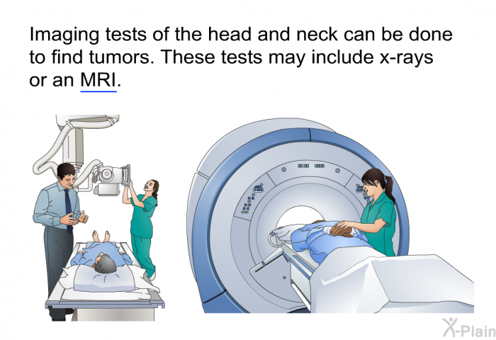 Imaging tests of the head and neck can be done to find tumors. These tests may include x-rays or an MRI.
