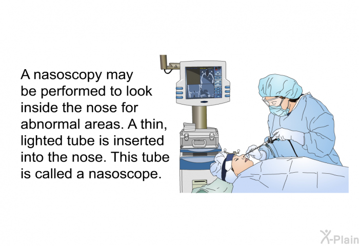 A nasoscopy may be performed to look inside the nose for abnormal areas. A thin, lighted tube is inserted into the nose. This tube is called a nasoscope.