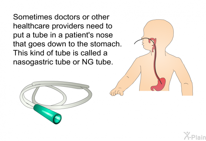 Sometimes doctors or other healthcare providers need to put a tube in a patient's nose that goes down to the stomach. This kind of tube is called a nasogastric tube or NG tube.