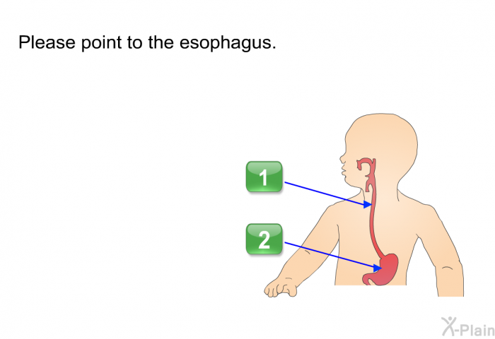 Please point to the esophagus.