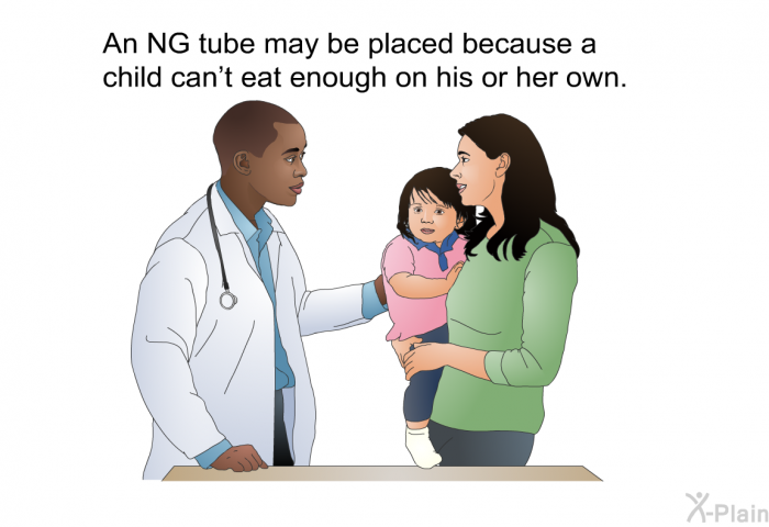 An NG tube may be placed because a child can't eat enough on his or her own.