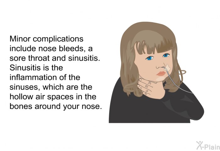 Minor complications include nose bleeds, a sore throat and sinusitis. Sinusitis is the inflammation of the sinuses, which are the hollow air spaces in the bones around your nose.