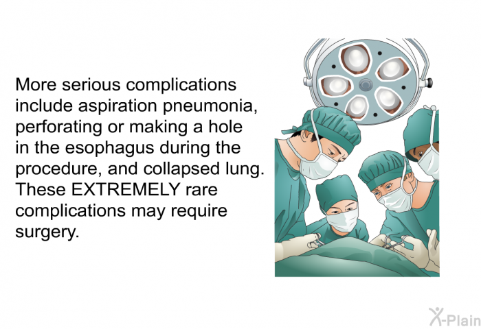 More serious complications include aspiration pneumonia, perforating or making a hole in the esophagus during the procedure, and collapsed lung. These EXTREMELY rare complications may require surgery.