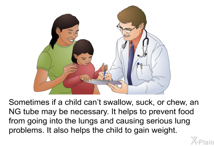 Sometimes if a child can't swallow, suck, or chew, an NG tube may be necessary. It helps to prevent food from going into the lungs and causing serious lung problems. It also helps the child to gain weight.