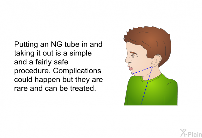 Putting an NG tube in and taking it out is a simple and a fairly safe procedure. Complications could happen but they are rare and can be treated.