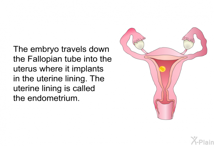 The embryo travels down the Fallopian tube into the uterus where it implants in the uterine lining. The uterine lining is called the endometrium.