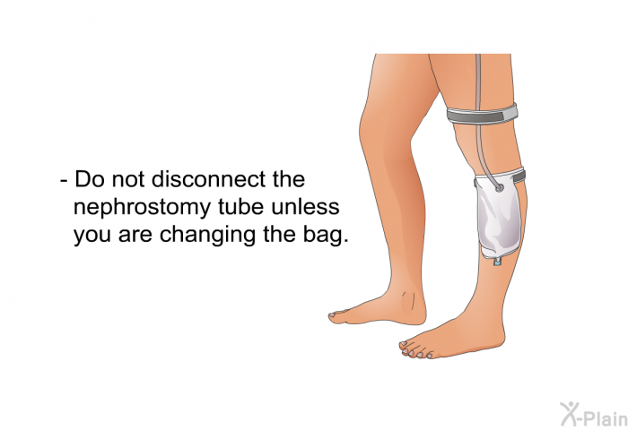 Do not disconnect the nephrostomy tube unless you are changing the bag.