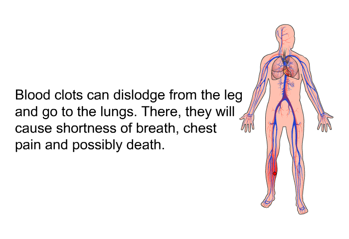 Blood clots can dislodge from the leg and go to the lungs. There, they will cause shortness of breath, chest pain and possibly death.