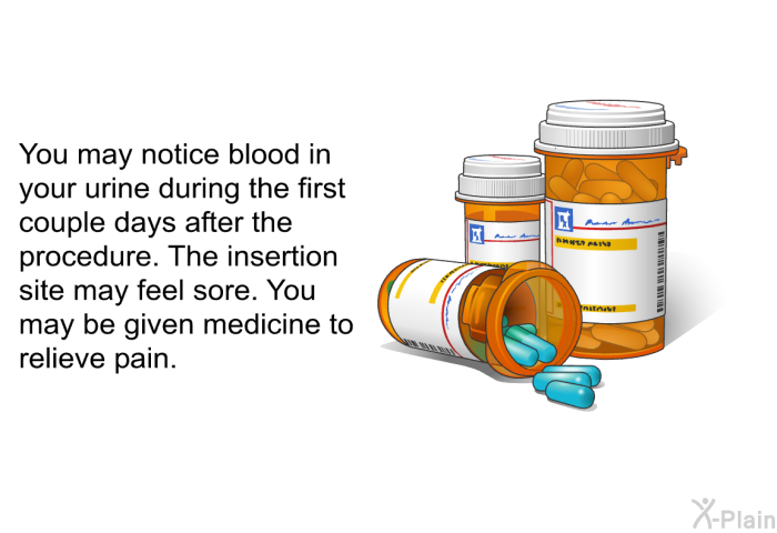 You may notice blood in your urine during the first couple days after the procedure. The insertion site may feel sore. You may be given medicine to relieve pain.