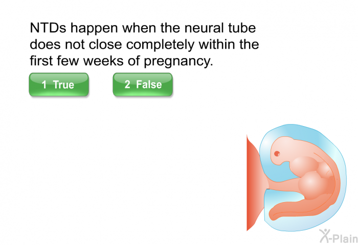NTDs happen when the neural tube does not close completely within the first few weeks of pregnancy. Select True or False.