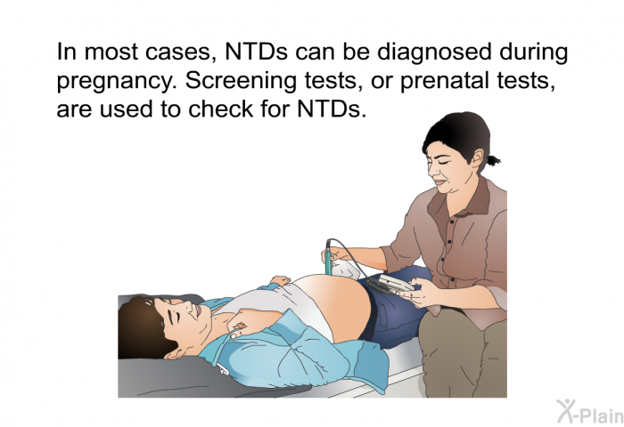 In most cases, NTDs can be diagnosed during pregnancy. Screening tests, or prenatal tests, are used to check for NTDs.