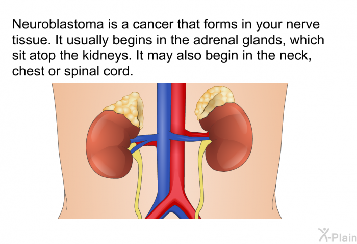 Neuroblastoma is a cancer that forms in your nerve tissue. It usually begins in the adrenal glands, which sit atop the kidneys. It may also begin in the neck, chest or spinal cord.