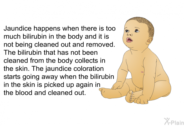Jaundice happens when there is too much bilirubin in the body and it is not being cleaned out and removed. The bilirubin that has not been cleaned from the body collects in the skin. The jaundice coloration starts going away when the bilirubin in the skin is picked up again in the blood and cleaned out.