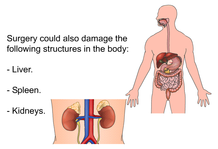 Surgery could also damage the following structures in the body:  Liver. Spleen. Kidneys.