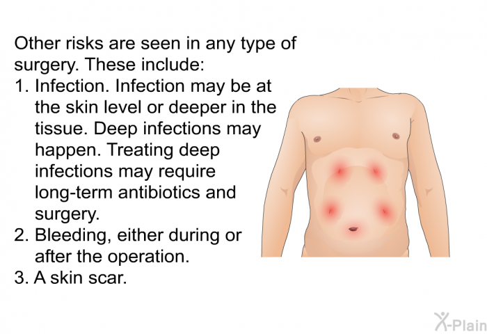 Other risks are seen in any type of surgery. These include:  Infection. Infection may be at the skin level or deeper in the tissue. Deep infections may happen. Treating deep infections may require long-term antibiotics and surgery. Bleeding, either during or after the operation. A skin scar.