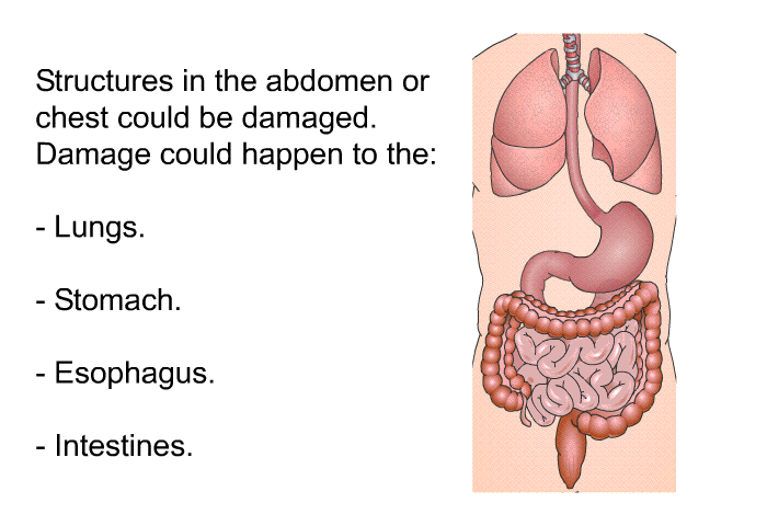 Structures in the abdomen or chest could be damaged. Damage could happen to the:  Lungs. Stomach. Esophagus. Intestines.