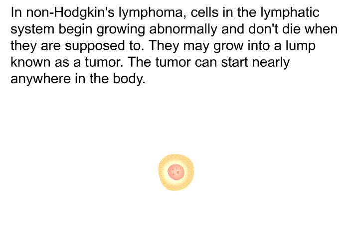 In non-Hodgkin's lymphoma, cells in the lymphatic system begin growing abnormally and don't die when they are supposed to. They may grow into a lump known as a tumor. The tumor can start nearly anywhere in the body.