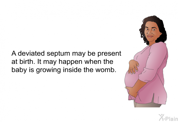 A deviated septum may be present at birth. It may happen when the baby is growing inside the womb.