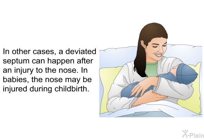 In other cases, a deviated septum can happen after an injury to the nose. In babies, the nose may be injured during childbirth.
