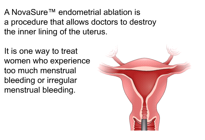 A NovaSure™ endometrial ablation is a procedure that allows doctors to destroy the inner lining of the uterus. It is one way to treat women who experience too much menstrual bleeding or irregular menstrual bleeding.