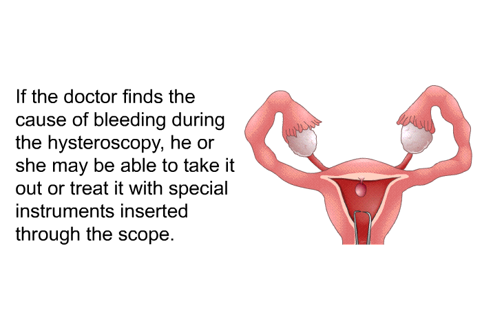 If the doctor finds the cause of bleeding during the hysteroscopy, he or she may be able to take it out or treat it with special instruments inserted through the scope.