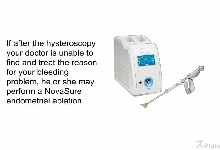 If after the hysteroscopy your doctor is unable to find and treat the reason for your bleeding problem, he or she may perform a NovaSure endometrial ablation.