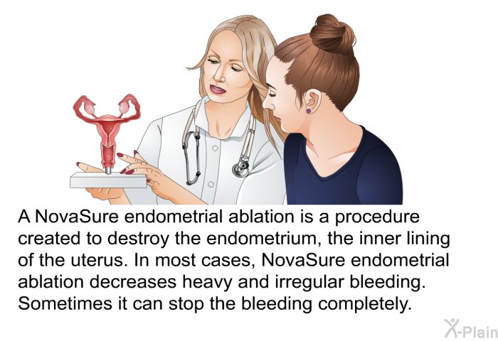A NovaSure endometrial ablation is a procedure created to destroy the endometrium, the inner lining of the uterus. In most cases, NovaSure endometrial ablation decreases heavy and irregular bleeding. Sometimes it can stop the bleeding completely.
