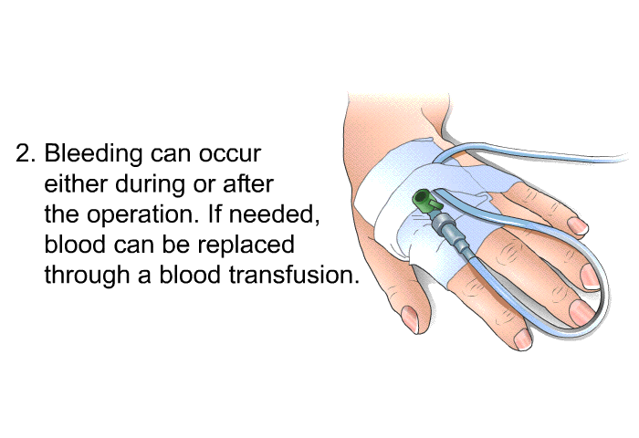Bleeding can occur either during or after the operation. If needed, blood can be replaced through a blood transfusion.