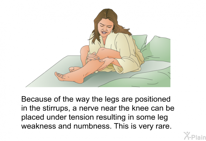 Because of the way the legs are positioned in the stirrups, a nerve near the knee can be placed under tension resulting in some leg weakness and numbness. This is very rare.