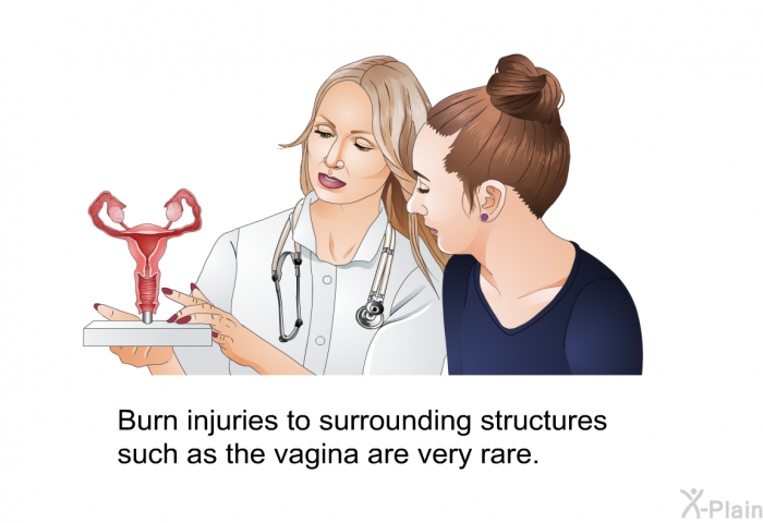 Burn injuries to surrounding structures such as the vagina are very rare.