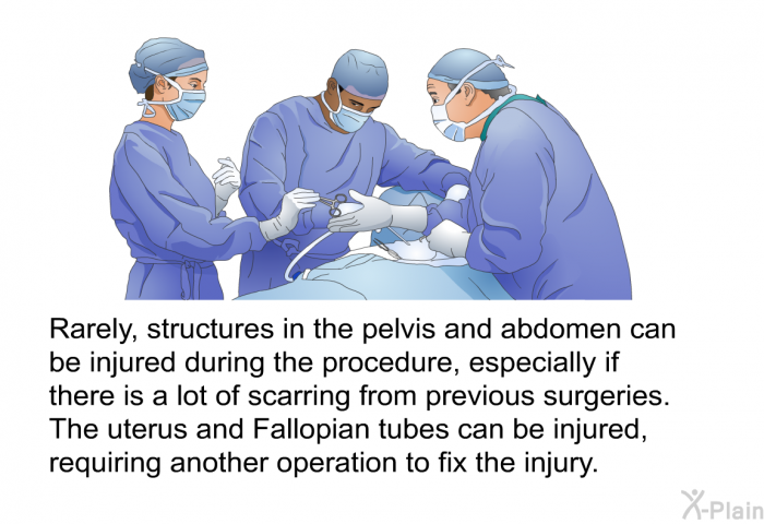 Rarely, structures in the pelvis and abdomen can be injured during the procedure, especially if there is a lot of scarring from previous surgeries. The uterus and Fallopian tubes can be injured, requiring another operation to fix the injury.