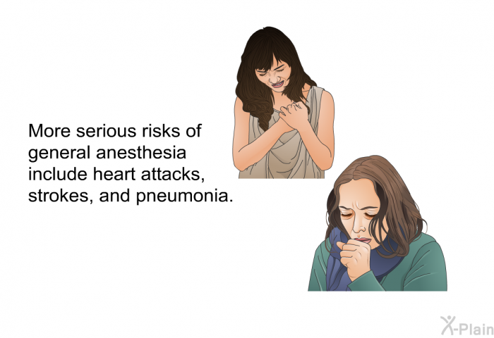 More serious risks of general anesthesia include heart attacks, strokes, and pneumonia.