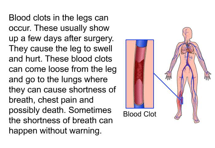 Blood clots in the legs can occur. These usually show up a few days after surgery. They cause the leg to swell and hurt. These blood clots can come loose from the leg and go to the lungs where they can cause shortness of breath, chest pain and possibly death. Sometimes the shortness of breath can happen without warning.