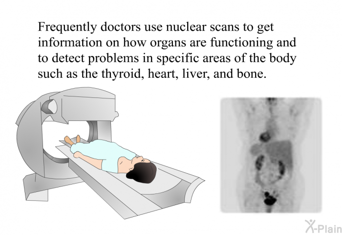Frequently, doctors use nuclear scans to get information on how organs are functioning and to detect problems in specific areas of the body such as the thyroid, heart, liver, and bone.