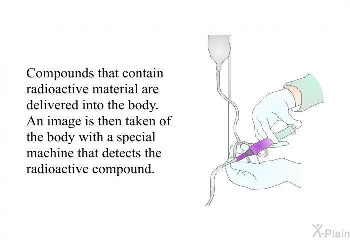 Compounds that contain radioactive material are delivered into the body. An image is then taken of the body with a special machine that detects the radioactive compound.