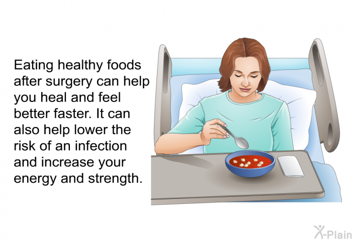 Eating healthy foods after surgery can help you heal and feel better faster. It can also help lower the risk of an infection and increase your energy and strength.