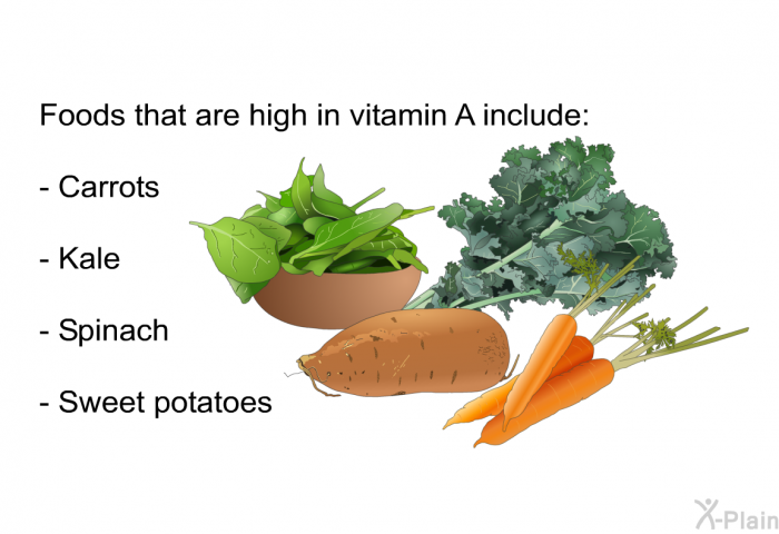 Foods that are high in vitamin A include:  Carrots Kale Spinach Sweet potatoes