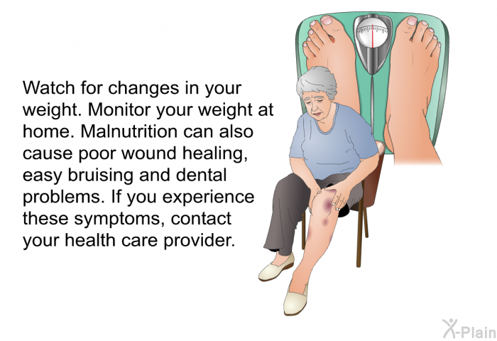 Watch for changes in your weight. Monitor your weight at home. Malnutrition can also cause poor wound healing, easy bruising and dental problems. If you experience these symptoms, contact your health care provider.