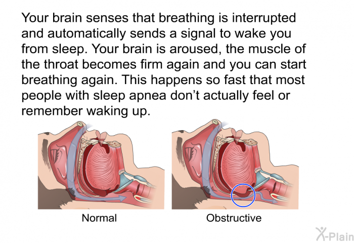 Your brain senses that breathing is interrupted and automatically sends a signal to wake you from sleep. Your brain is aroused, the muscle of the throat becomes firm again and you can start breathing again. This happens so fast that most people with sleep apnea don't actually feel or remember waking up.