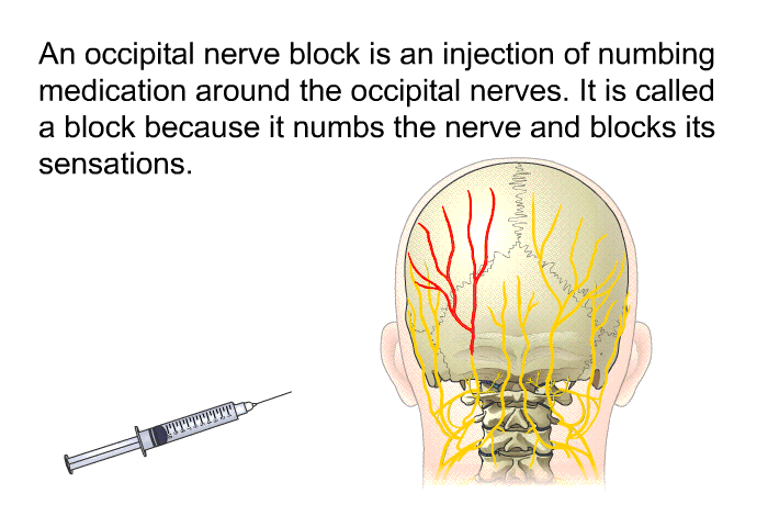 An occipital nerve block is an injection of numbing medication around the occipital nerves. It is called a block because it numbs the nerve and blocks its sensations.