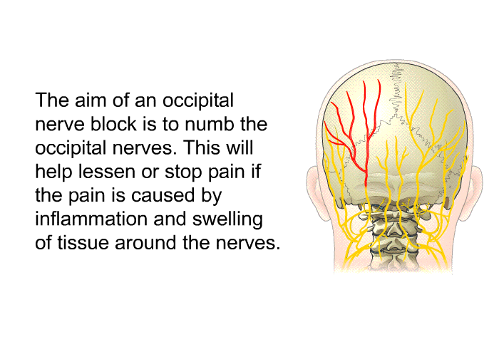 The aim of an occipital nerve block is to numb the occipital nerves. This will help lessen or stop pain if the pain is caused by inflammation and swelling of tissue around the nerves.