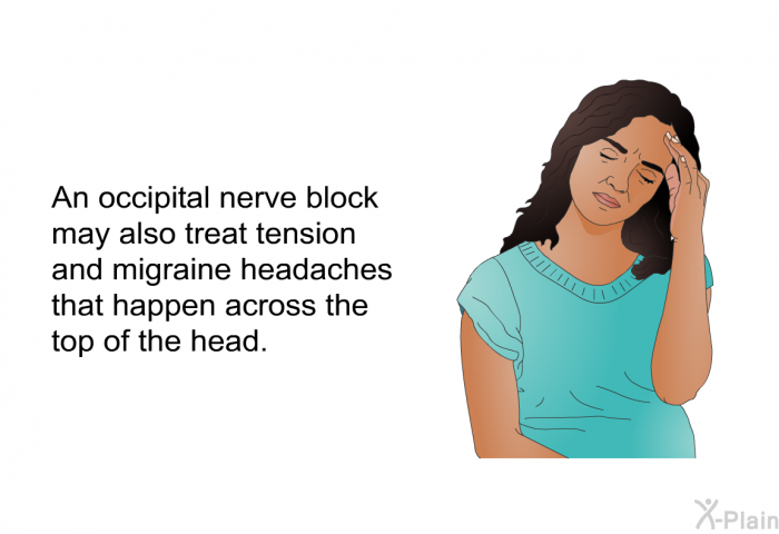 An occipital nerve block may also treat tension and migraine headaches that happen across the top of the head.