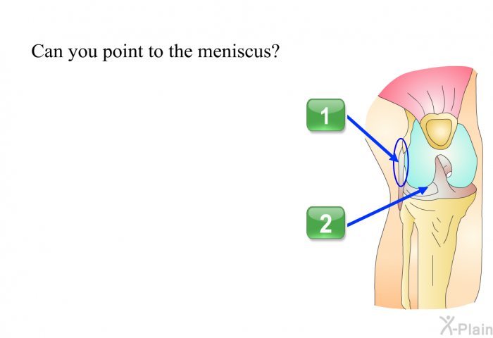 Can you point to the meniscus? Select 1 or 2